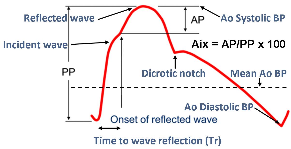 CAP waveform